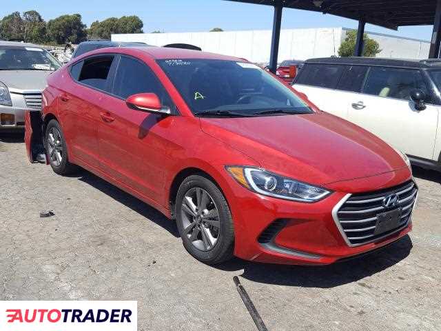 Hyundai Elantra 2017 2 Hyundai Elantra 2017 2