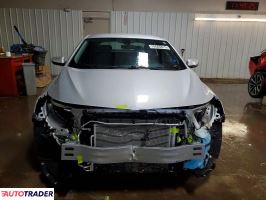 Chevrolet Malibu 2022 1